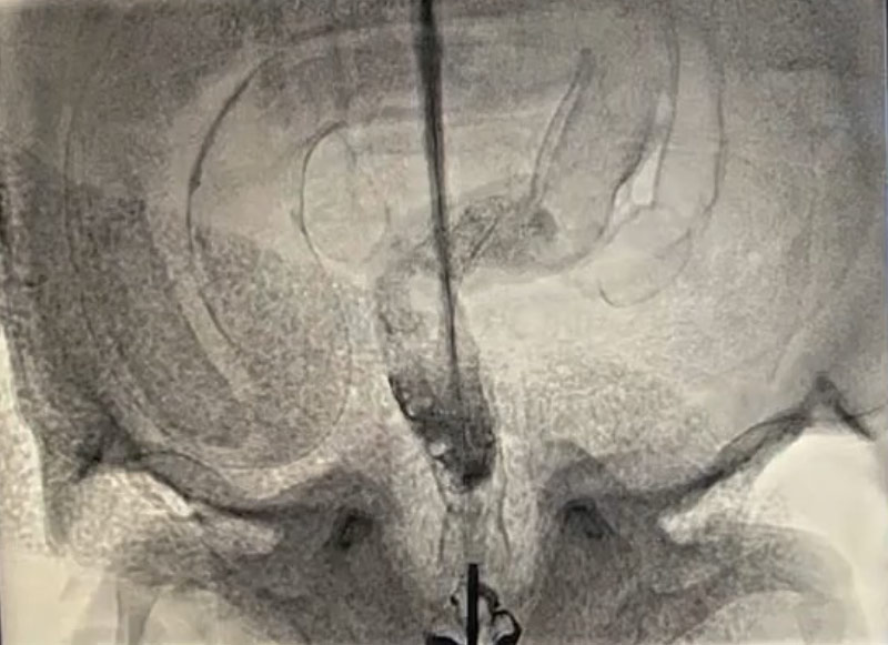 viries-dunn-03 viries-dunn-03